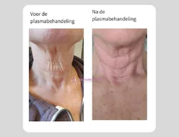 Huidkliniek Derma Sensation