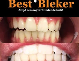 BestBleker