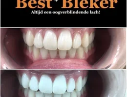 BestBleker